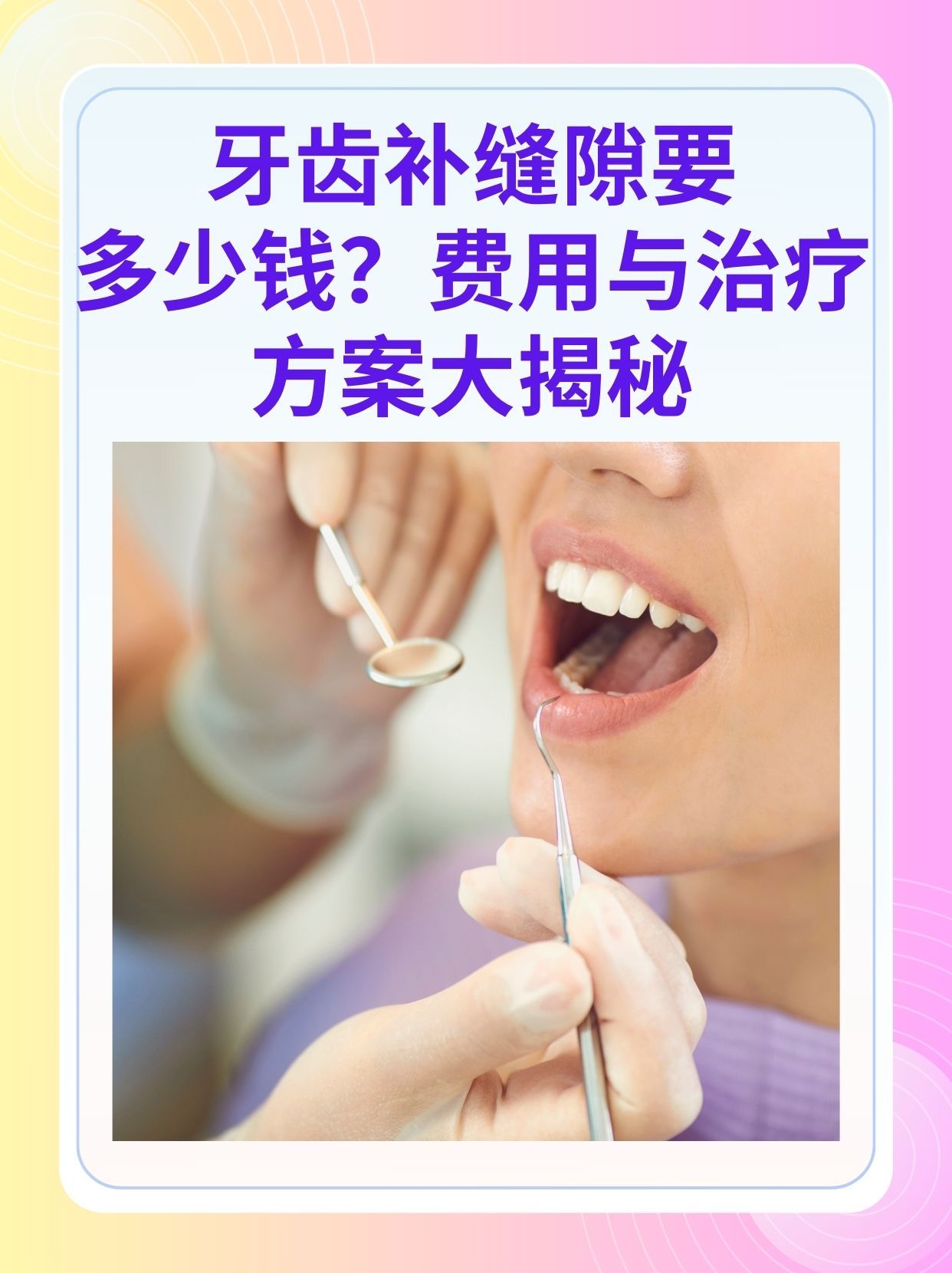 宜昌补牙医保可以报销吗(补牙医保可以报销吗 哪些可以报销呢)